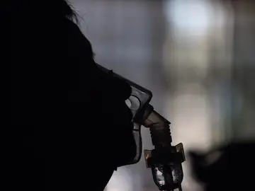 Paciente con esclerosis múltiple Paciente con esclerosis múltiple