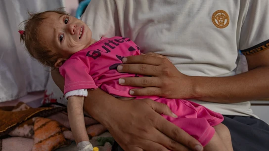 Maryam Abu Daqqa, una niña palestina de dos años que sufre desnutrición Maryam Abu Daqqa, una niña palestina de dos años que sufre desnutrición