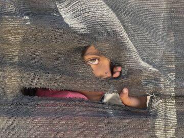 Pediatras espa&ntilde;oles piden una respuesta &eacute;tica ante las miles de muertes de ni&ntilde;os por hambre en Gaza