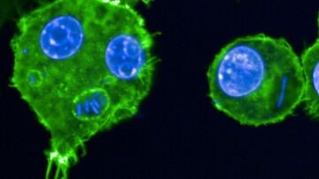 Macrófagos infectados con la bacteria que causa la peste 'Yersinia pestis'