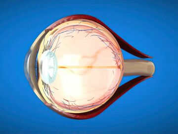 El glaucoma afecta al nervio &oacute;ptico y a la retina