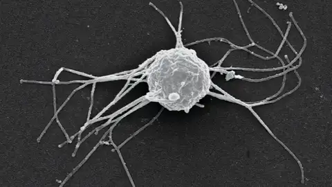 'Ministeria vibrans', un pequeño eucariota unicelular que se alimenta de bacterias 'Ministeria vibrans', un pequeño eucariota unicelular que se alimenta de bacterias