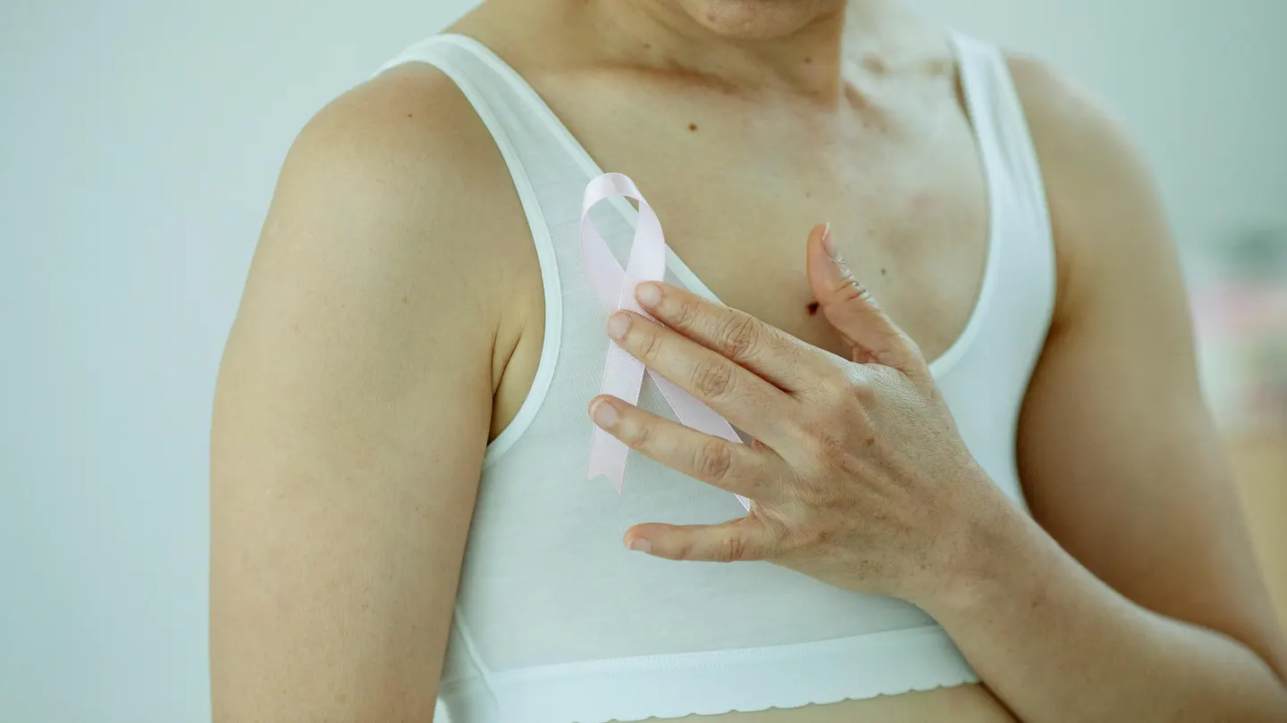 Cáncer de mama Cáncer de mama