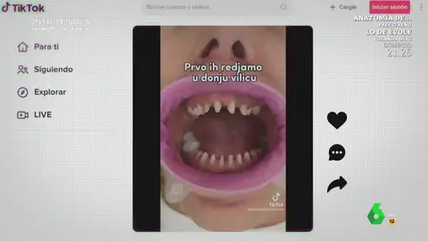 Un dentista, tajante sobre la moda de sustituir todos los dientes por coronas: "Es una salvajada" Un dentista, tajante sobre la moda de sustituir todos los dientes por coronas: "Es una salvajada"