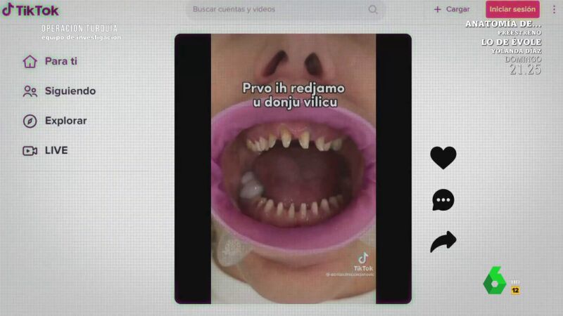 Un dentista, tajante sobre la moda de sustituir todos los dientes por coronas: "Es una salvajada"