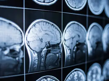 Cerebro Cerebro