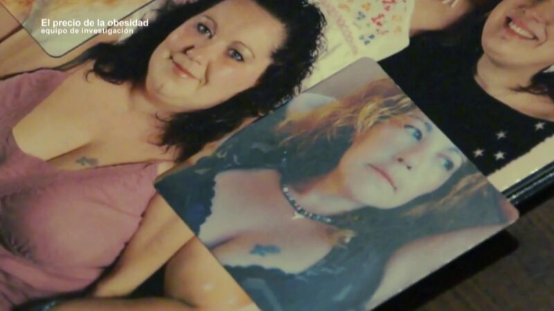 "Mi cuerpo se quedó fatal después de la reducción de estómago": el testimonio de una mujer que perdió 60 kg en 2 años