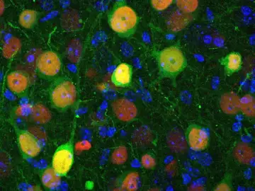 Células de la amígdala basolatera Células de la amígdala basolatera