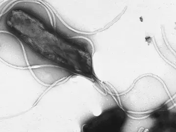 Helicobacter pylori bajo microscopio Helicobacter pylori bajo microscopio