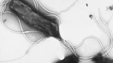 Helicobacter pylori bajo microscopio Helicobacter pylori bajo microscopio