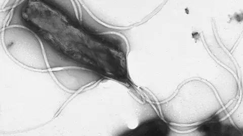 Helicobacter pylori bajo microscopio Helicobacter pylori bajo microscopio