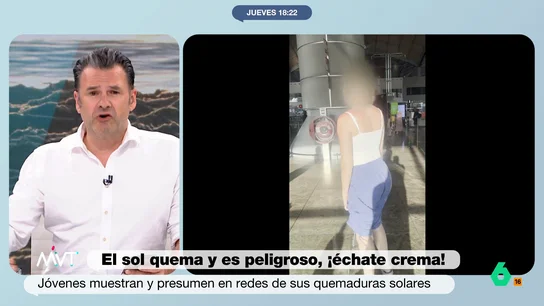 Iñaki López, a los que exhiben sus quemaduras solares en redes: "En mis tiempos, si eras idiota tratabas de ocultarlo" En las redes se han popularizado nuevas tendencias que tienen que ver con la exposición solar. Por ejemplo, presumir de sus quemaduras, tener marcas solares o conseguir el llamado callo solar.