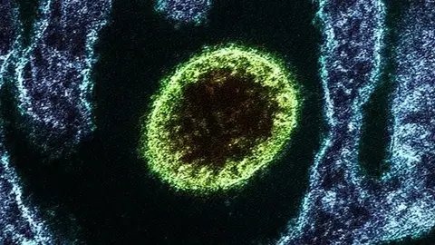 Virus Nipah Virus Nipah