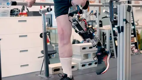 Una rodilla biónica integrada en el tejido devuelve la movilidad natural tras una amputación Una rodilla biónica integrada en el tejido devuelve la movilidad natural tras una amputación