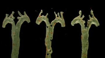 Arteria aorta
