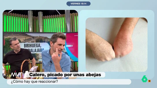 Calero y los picotazos de abeja que sufrió en los campos de lavanda de Brihuega Luis Calero desvela en Más Vale Tarde el percance que sufrió durante su reportaje en los campos de lavanda de Brihuega. Dos picotazos de abeja que doblaron el tamaño de su mano. Su historia, en este vídeo.