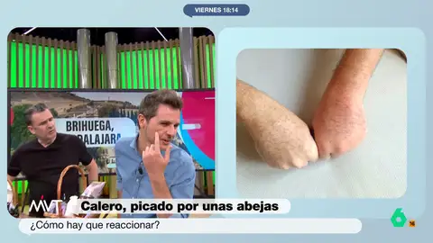 Calero y los picotazos de abeja que sufrió en los campos de lavanda de Brihuega Luis Calero desvela en Más Vale Tarde el percance que sufrió durante su reportaje en los campos de lavanda de Brihuega. Dos picotazos de abeja que doblaron el tamaño de su mano. Su historia, en este vídeo.
