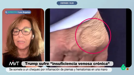 María Estévez, sobre las informaciones acerca de la salud de Trump: "Él tiende a disimular las cosas y decirte algo que no es cierto" "La gente se está preguntando cuándo se tomó la decisión de hacer un examen exhaustivo al presidente", comenta la corresponsal de laSexta tras el comunicado de la Casa Blanca sobre la insuficiencia venosa crónica de Trump.