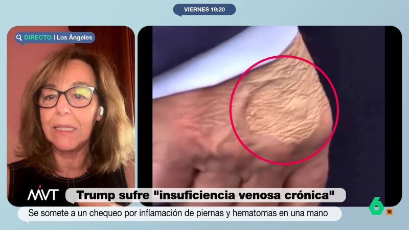 María Estévez, sobre las informaciones acerca de la salud de Trump: "Él tiende a disimular las cosas y decirte algo que no es cierto"