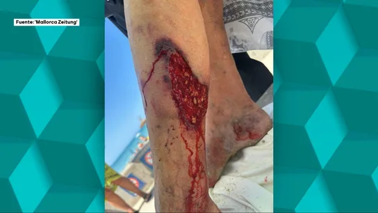¿Tiburón o raya látigo? Cierran durante horas una playa de Palma tras un ataque a una turista ¿Tiburón o raya látigo? Cierran durante horas una playa de Palma tras un ataque a una turista