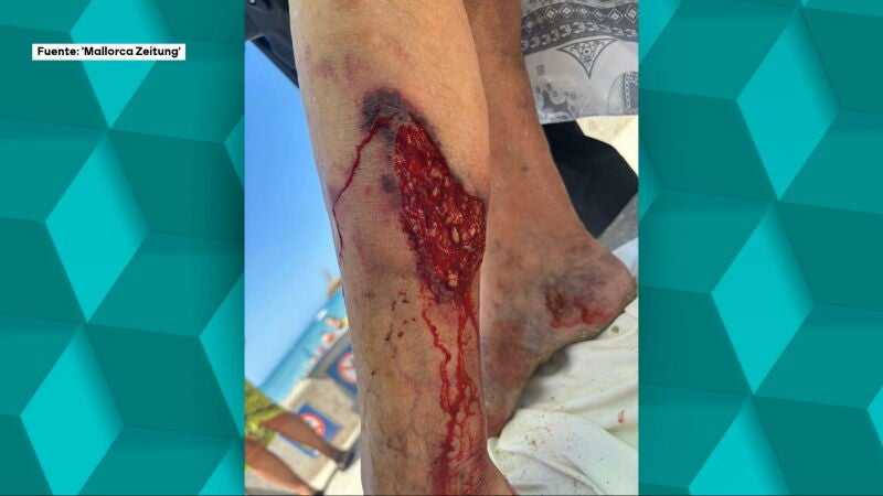 ¿Tiburón o raya látigo? Cierran durante horas una playa de Palma tras un ataque a una turista 