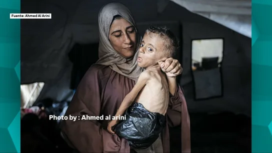 Mohammed, el niño de un año que pesa como uno de tres meses y cuyo rostro muestra el horror en Gaza. Mohammed, el niño de un año que pesa como uno de tres meses y cuyo rostro muestra el horror en Gaza.