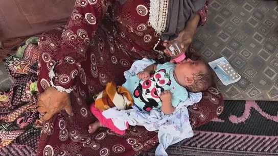 La desnutrición en Gaza ya es una realidad en miles de niños. La desnutrición en Gaza ya es una realidad en miles de niños.
