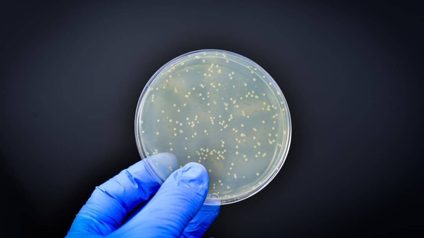 Cultivo de bacterias