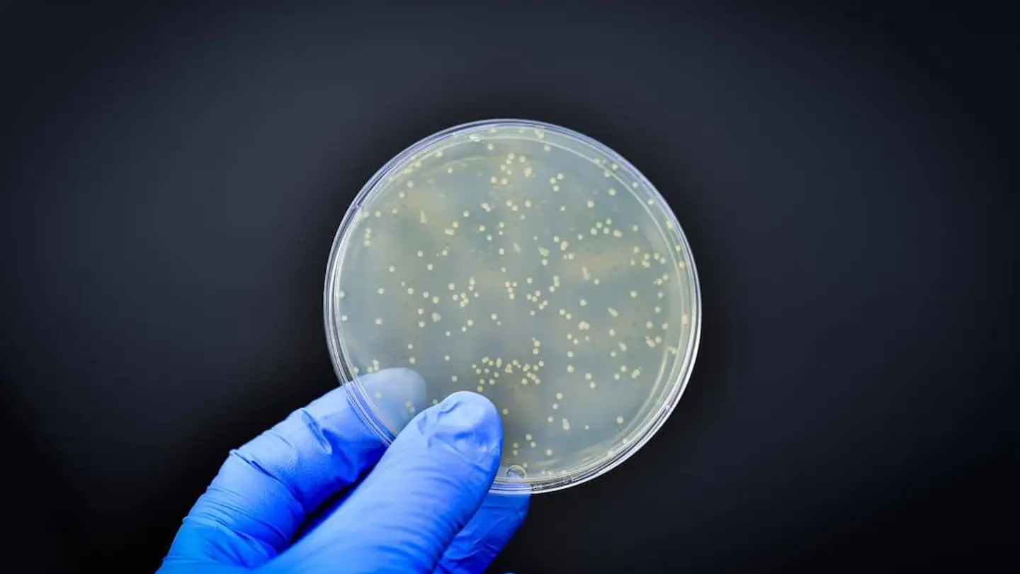 Cultivo de bacterias Cultivo de bacterias