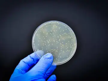 Cultivo de bacterias Cultivo de bacterias
