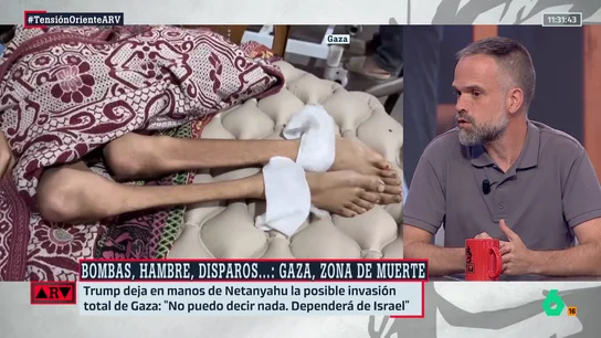 Un médico en Gaza describe el infierno diario: “Buscar comida es peligrosísimo” Un médico en Gaza describe el infierno diario: “Buscar comida es peligrosísimo”