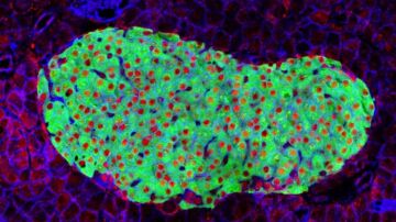 Célula pancreática
