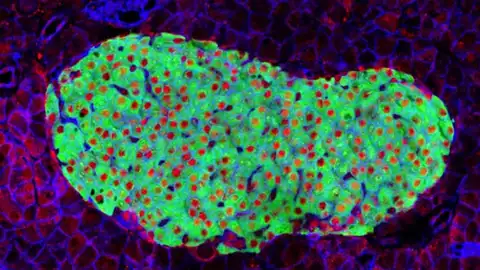 Célula pancreática Célula pancreática