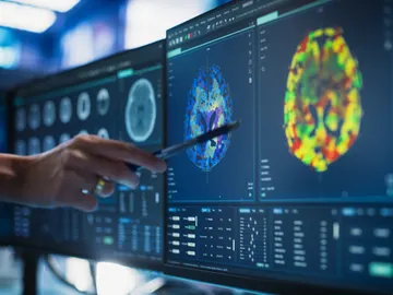 Estudio del cerebro Estudio del cerebro