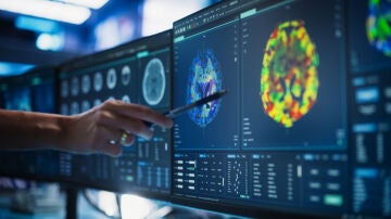 Estudio del cerebro