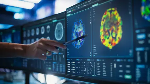 Estudio del cerebro Estudio del cerebro