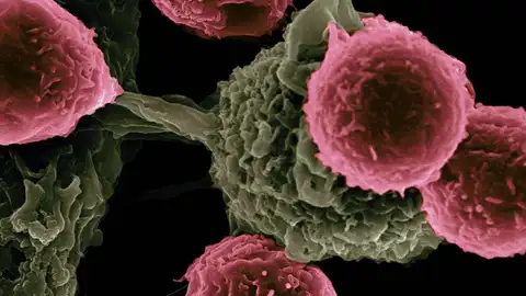 Vacunas inmunoterápicas Vacunas inmunoterápicas