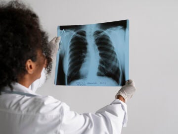 Nuevo frente contra el c&aacute;ncer de pulm&oacute;n m&aacute;s agresivo