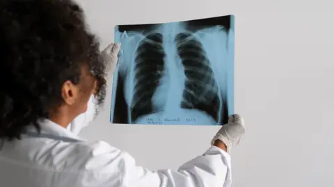 Nuevo frente contra el cáncer de pulmón más agresivo Análisis de una ecografía de pulmones