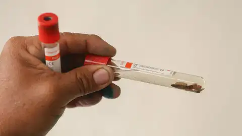 Muestra del gusano barrenador Muestra del gusano barrenador