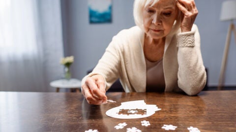 Mujer con Alzheimer
