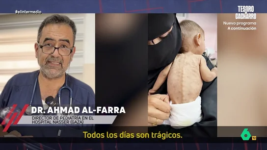 "Por favor, traten al pueblo palestino como seres humanos": la petición de Ahmad Al-Farra, doctor en Gaza El pediatra manifiesta que la situación del hospital es límite ya que apenas disponen de medicación o leche de fórmula para los niños ingresados. Esto provoca que muchos sufran desnutrición severa.