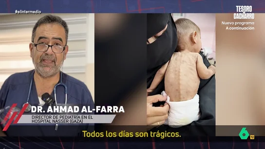 Un pediatra de Gaza pide "ayuda urgente" tras atender a 140 niños en un día: "Nunca habíamos visto nada así" Un pediatra de Gaza pide "ayuda urgente" tras atender a 140 niños en un día: "Nunca habíamos visto nada así"