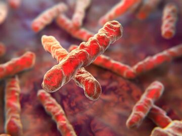 Bacteria Mycobacterium tuberculosis