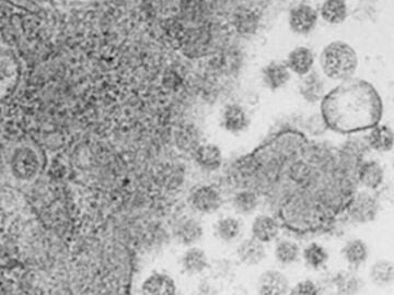 Virus del SARS-CoV-2 saliendo de las c&eacute;lulas infectadas