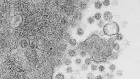 Virus del SARS-CoV-2 saliendo de las células infectadas Virus del SARS-CoV-2 saliendo de las células infectadas
