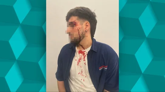 Agresión homófoba en Almería. Agresión homófoba en Almería.