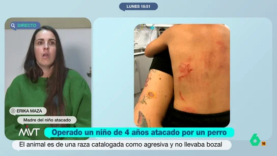 Habla la madre del menor atacado por un perro en Cantabria: "El niño solo me gritaba: 'Mamá, quítamelo de encima'" Habla la madre del menor atacado por un perro en Cantabria: "El niño solo me gritaba: 'Mamá, quítamelo de encima'"