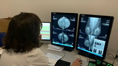 Una médico observa una mamografía La prevención y la detección precoz, claves del Día Mundial del Cáncer de Mama