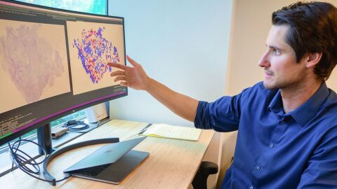 Erik Bergstrom, coautor del estudio, analiza los resultados de una biopsia de cáncer de mama